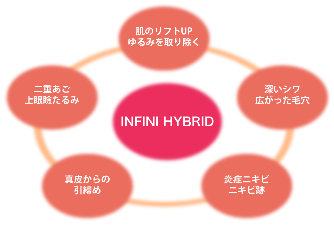 INFINI HYBRID 治療の利点